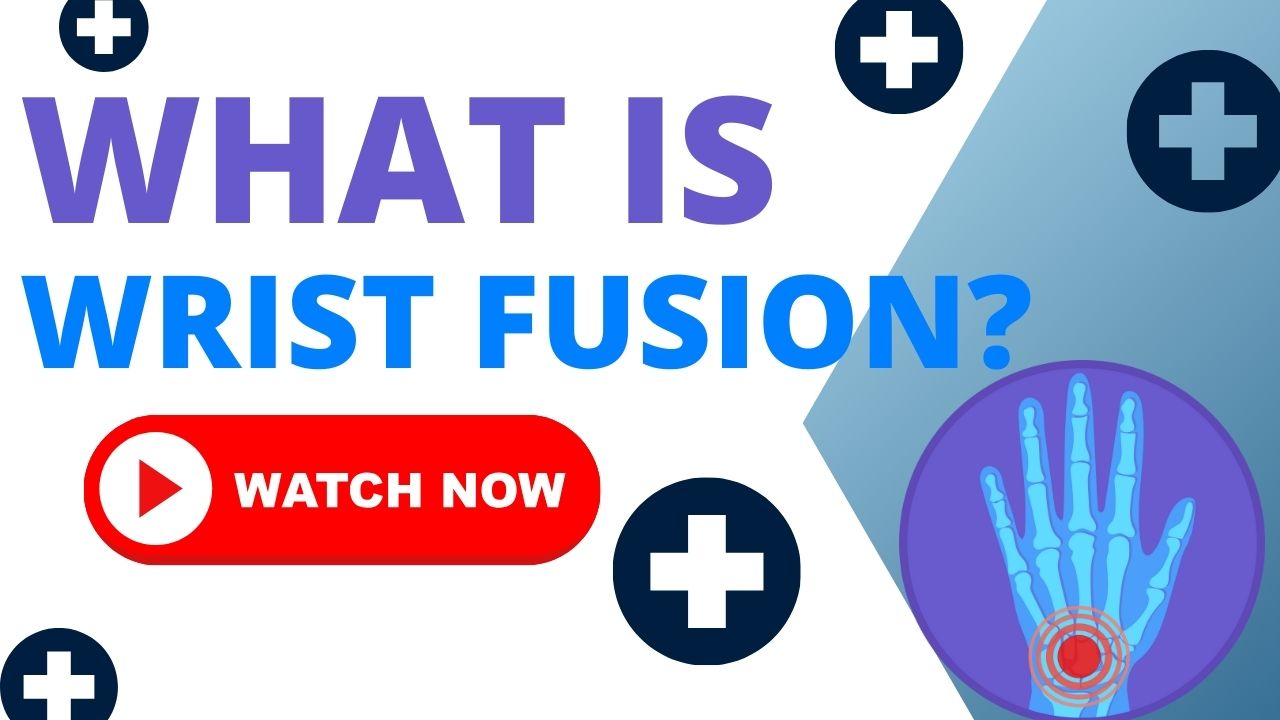 Wrist Fusion